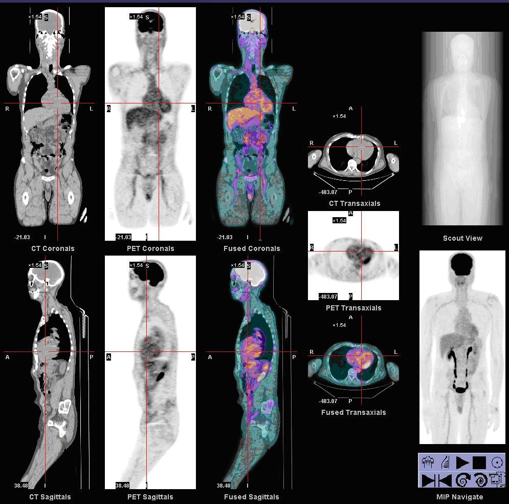 the-future-of-nuclear-medicine