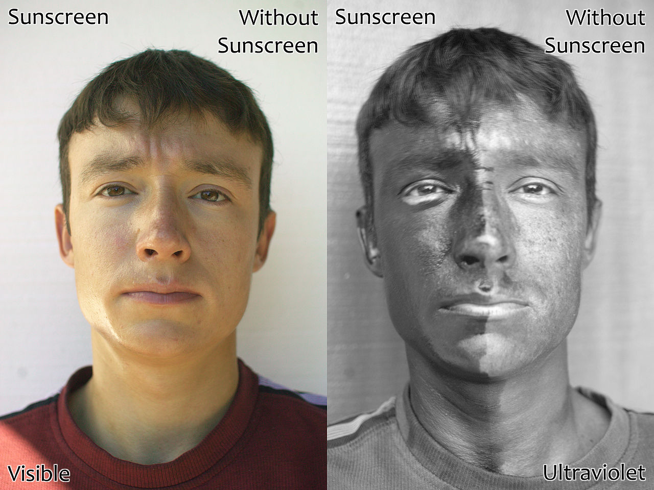 Ultraviolet Radiation and Sunscreen